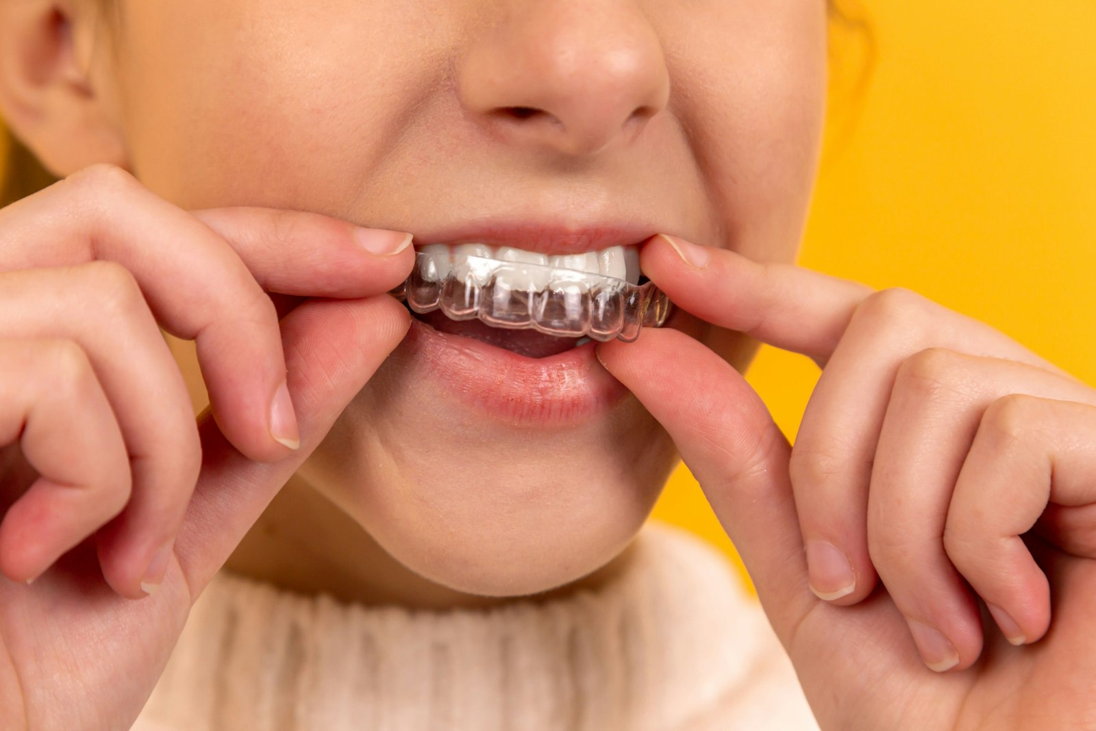 Clear aligner tray